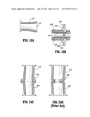 End-To-End Anastomosis Instrument and Method for Performing Same diagram and image