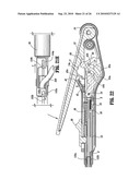 End-To-End Anastomosis Instrument and Method for Performing Same diagram and image