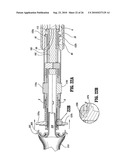 End-To-End Anastomosis Instrument and Method for Performing Same diagram and image