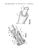 End-To-End Anastomosis Instrument and Method for Performing Same diagram and image