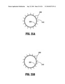 End-To-End Anastomosis Instrument and Method for Performing Same diagram and image