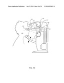 ORTHOVOLTAGE RADIOSURGERY diagram and image