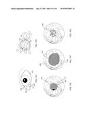 ORTHOVOLTAGE RADIOSURGERY diagram and image