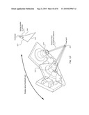 ORTHOVOLTAGE RADIOSURGERY diagram and image