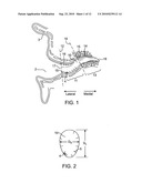 TOOL FOR INSERTION AND REMOVAL OF IN-CANAL HEARING DEVICES diagram and image