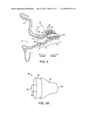 TOOL FOR INSERTION AND REMOVAL OF IN-CANAL HEARING DEVICES diagram and image