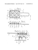 Device for Determining the 3D Coordinates of an Object, In Particular of a Tooth diagram and image