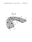 Device for Determining the 3D Coordinates of an Object, In Particular of a Tooth diagram and image