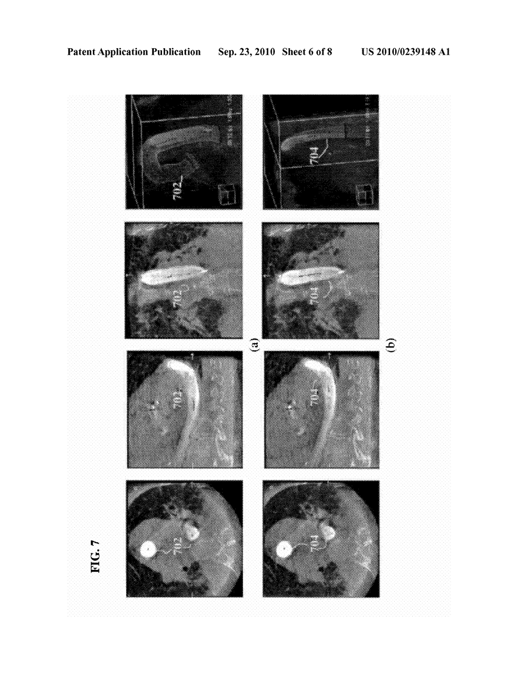 Method and System for Automatic Aorta Segmentation - diagram, schematic, and image 07