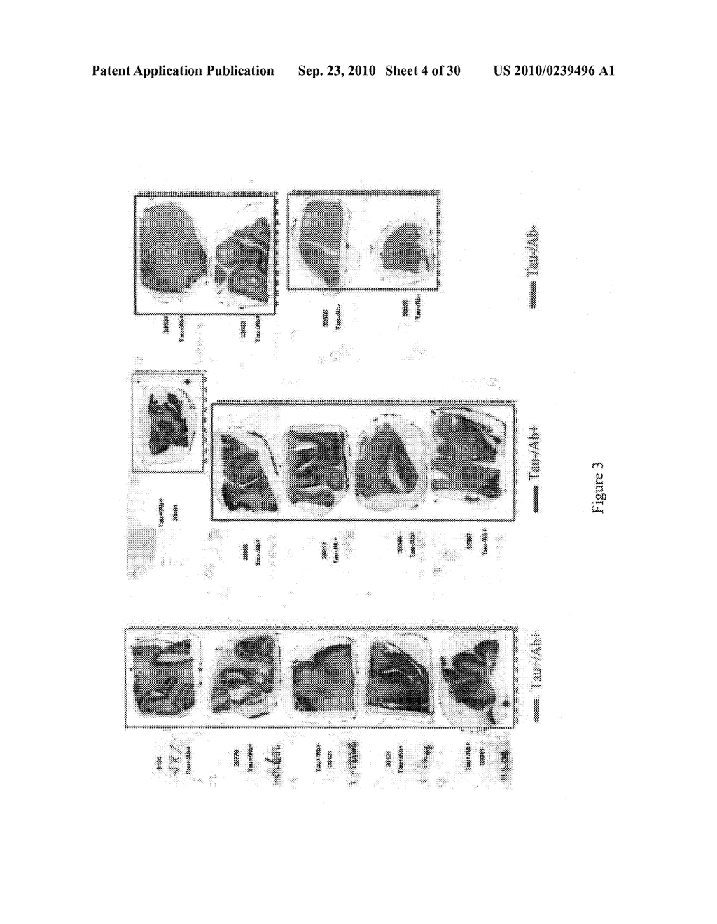 Imaging agents for detecting neurological disorders - diagram, schematic, and image 05