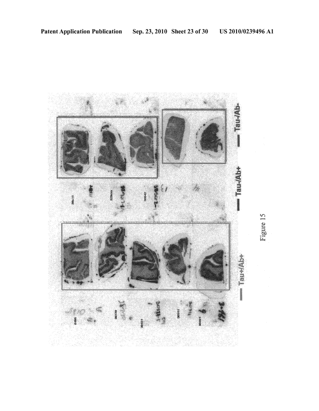 Imaging agents for detecting neurological disorders - diagram, schematic, and image 24