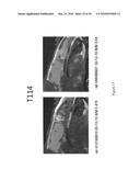 Imaging agents for detecting neurological disorders diagram and image