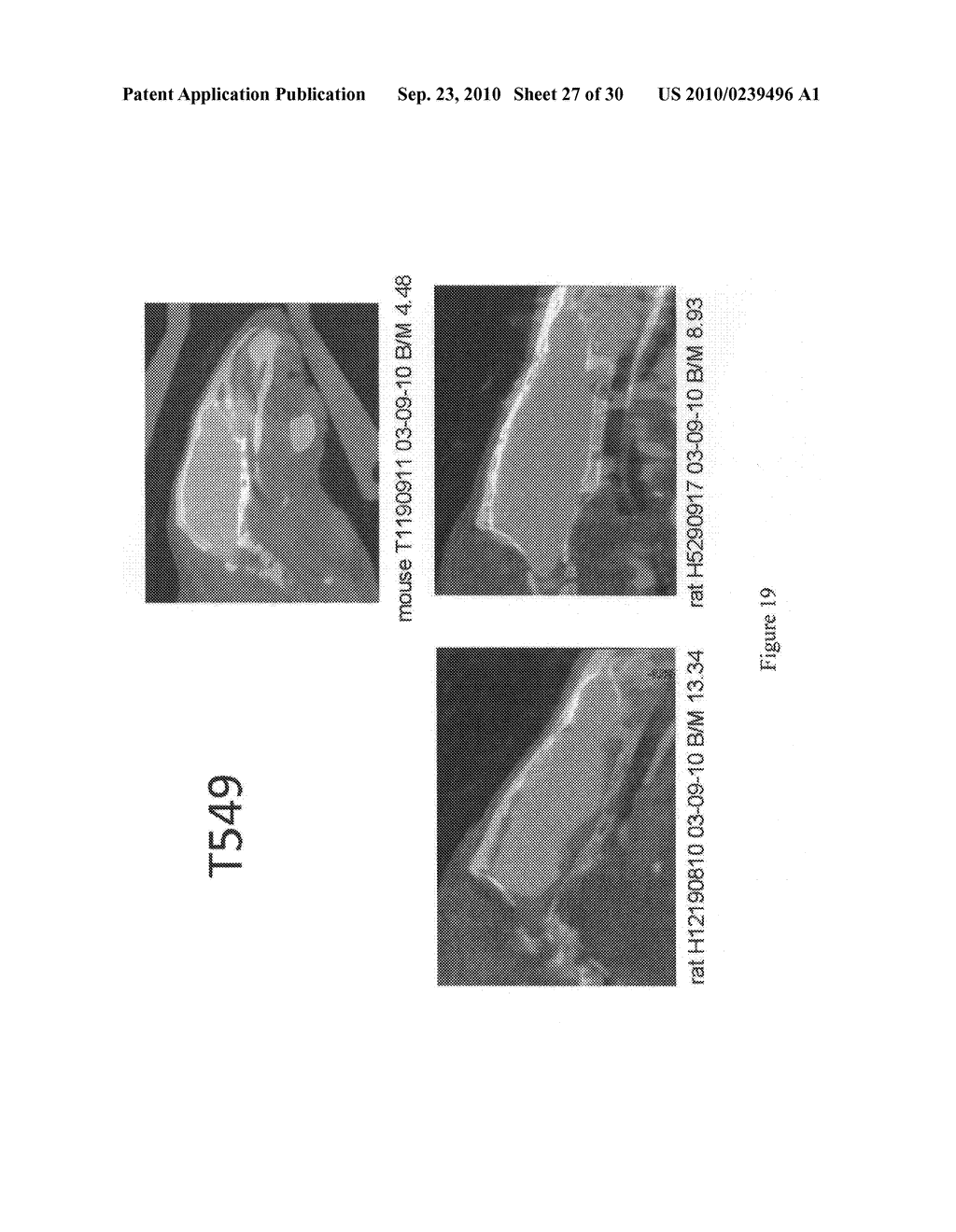 Imaging agents for detecting neurological disorders - diagram, schematic, and image 28