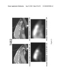 Imaging agents for detecting neurological disorders diagram and image