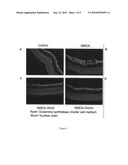 Methods and compositions for genetic and retinal disease diagram and image