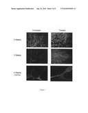 Methods and compositions for genetic and retinal disease diagram and image