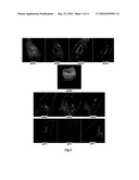 CALCIUM-BINDING AGENTS INDUCE HAIR GROWTH AND/OR NAIL GROWTH diagram and image