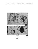 CALCIUM-BINDING AGENTS INDUCE HAIR GROWTH AND/OR NAIL GROWTH diagram and image