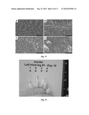 CALCIUM-BINDING AGENTS INDUCE HAIR GROWTH AND/OR NAIL GROWTH diagram and image