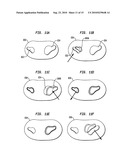 SELF-LOCATING, MULTIPLE APPLICATION, AND MULTIPLE LOCATION MEDICAL PATCH SYSTEMS AND METHODS THEREFOR diagram and image