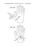 SELF-LOCATING, MULTIPLE APPLICATION, AND MULTIPLE LOCATION MEDICAL PATCH SYSTEMS AND METHODS THEREFOR diagram and image