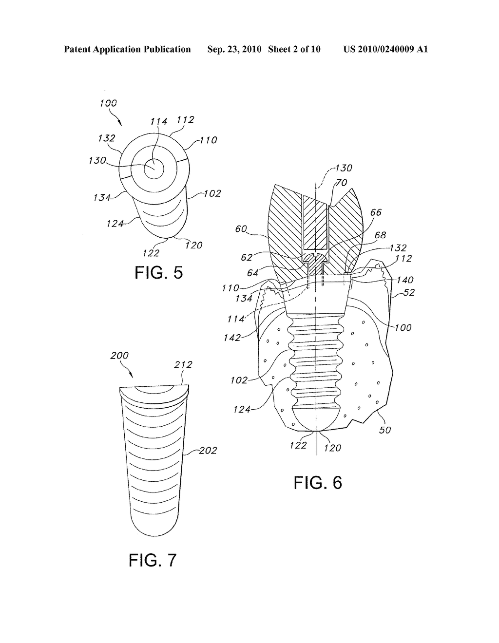 ASYMMETRICAL DENTAL IMPLANT AND METHOD OF INSERTION - diagram, schematic, and image 03