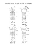 ASYMMETRICAL DENTAL IMPLANT AND METHOD OF INSERTION diagram and image