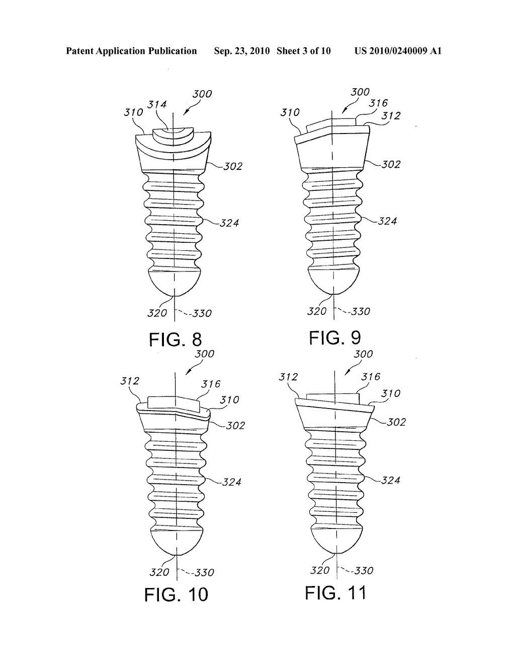 ASYMMETRICAL DENTAL IMPLANT AND METHOD OF INSERTION - diagram, schematic, and image 04