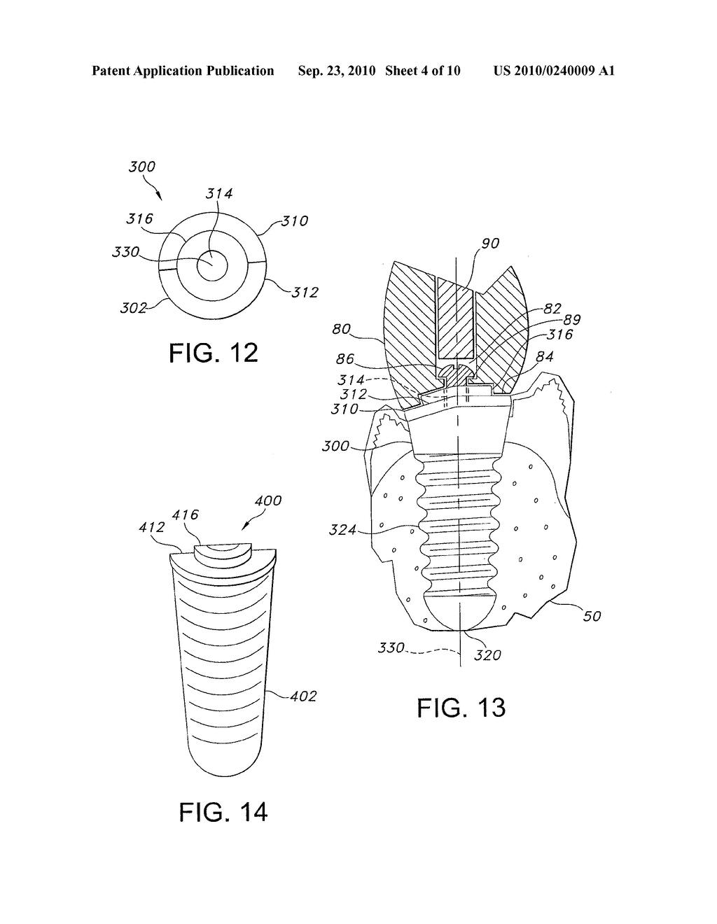 ASYMMETRICAL DENTAL IMPLANT AND METHOD OF INSERTION - diagram, schematic, and image 05