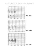 SUBSTRATE POLISHING METROLOGY USING INTERFERENCE SIGNALS diagram and image