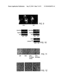 Heyl as a Therapeutic Target and a Diagnostic Marker for Neoplasia and Uses Therefor diagram and image