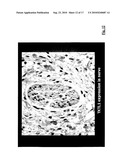 METHOD FOR CHECKING AND CONTROLLING THE MAMMALIAN LACTIC ACID FERMENTATION PROCESS/AEROBIC GLUCOSE FERMENTATION METABOLIC PATHWAY IN MAMMALIAN ORGANISM diagram and image