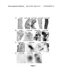 WIDESPREAD GENE DELIVERY TO MOTOR NEURONS USING PERIPHERAL INJECTION OF AAV VECTORS diagram and image