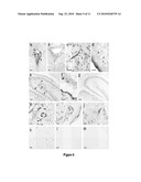 WIDESPREAD GENE DELIVERY TO MOTOR NEURONS USING PERIPHERAL INJECTION OF AAV VECTORS diagram and image