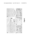 WIDESPREAD GENE DELIVERY TO MOTOR NEURONS USING PERIPHERAL INJECTION OF AAV VECTORS diagram and image