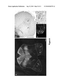 WIDESPREAD GENE DELIVERY TO MOTOR NEURONS USING PERIPHERAL INJECTION OF AAV VECTORS diagram and image