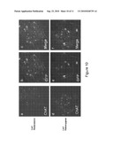 WIDESPREAD GENE DELIVERY TO MOTOR NEURONS USING PERIPHERAL INJECTION OF AAV VECTORS diagram and image