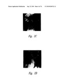 ANTI-ANGIOGENIC COMPOSITIONS AND METHODS OF USE diagram and image