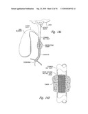 ANTI-ANGIOGENIC COMPOSITIONS AND METHODS OF USE diagram and image