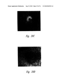 ANTI-ANGIOGENIC COMPOSITIONS AND METHODS OF USE diagram and image