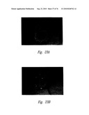 ANTI-ANGIOGENIC COMPOSITIONS AND METHODS OF USE diagram and image