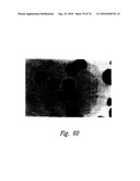 ANTI-ANGIOGENIC COMPOSITIONS AND METHODS OF USE diagram and image