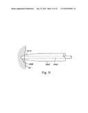 DEVICES FOR MINIMALLY INVASIVE PELVIC SURGERY diagram and image