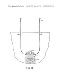 DEVICES FOR MINIMALLY INVASIVE PELVIC SURGERY diagram and image