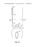 DEVICES FOR MINIMALLY INVASIVE PELVIC SURGERY diagram and image