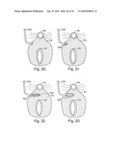 DEVICES FOR MINIMALLY INVASIVE PELVIC SURGERY diagram and image