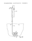 DEVICES FOR MINIMALLY INVASIVE PELVIC SURGERY diagram and image