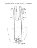 DEVICES FOR MINIMALLY INVASIVE PELVIC SURGERY diagram and image