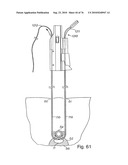 DEVICES FOR MINIMALLY INVASIVE PELVIC SURGERY diagram and image