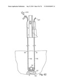 DEVICES FOR MINIMALLY INVASIVE PELVIC SURGERY diagram and image